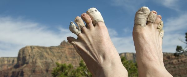 how to prevent blisters while hiking